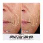Shark CryoGlow Under Eye Cooling & LED Repair Mask - Pink - FW312UKPK